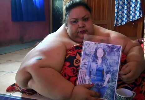 Indonesia’s fattest woman needs to be lifted out of home’s w