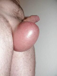 My ball sack is filled with saline - 8 Pics xHamster
