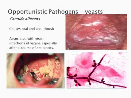 Clinically Relevant Fungi - ppt video online download