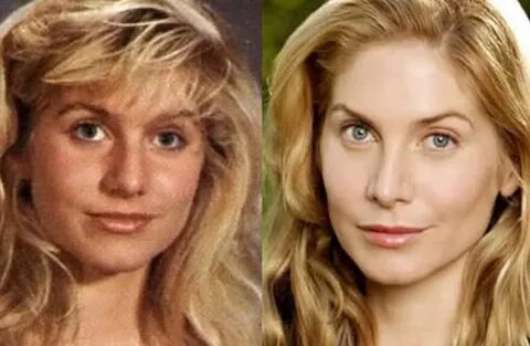 Elizabeth Mitchell Nose Job Plastic Surgery Before and After