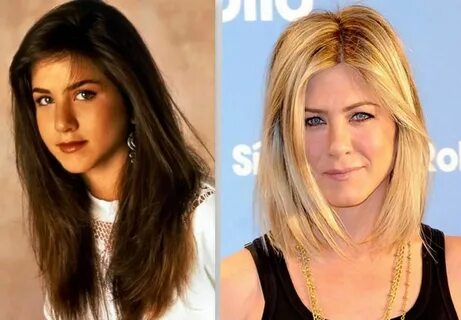 Jennifer Aniston Before and after a Nose Job Celebrity plast