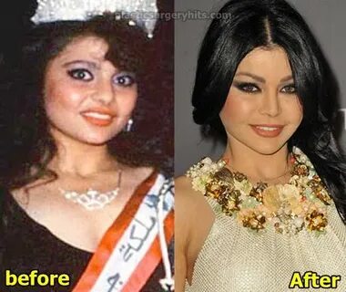 Haifa Wehbe Plastic Surgery Before and After - Plastic Surge