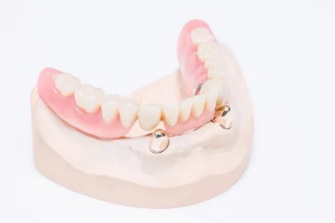 Zahnersatz - Zahnarztpraxis Solingen