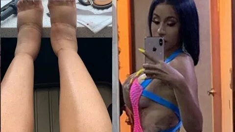 Cardi B CLAPS BACK With A NASTY Photo Of Her Swollen Feet! -