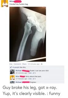 ✅ 25+ Best Memes About Knee Xray Knee Xray Memes