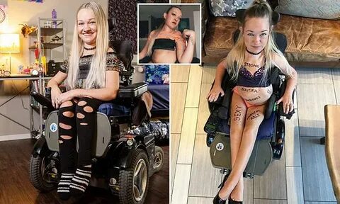 Alex Dacy dubbed 'Wheelchair Rapunzel' who was born with spi