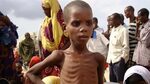 La famine a emporté 258 000 personnes en Somalie Radio-Canad