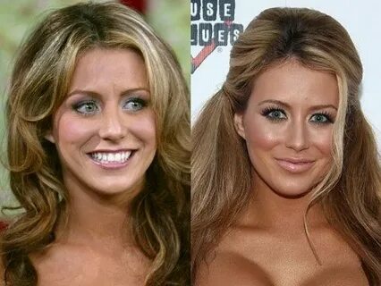 Stars who age badly (With images) Celebrity plastic surgery,