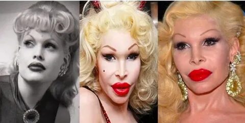 10 Times Plastic Surgery Went Horribly Wrong for Celebrities