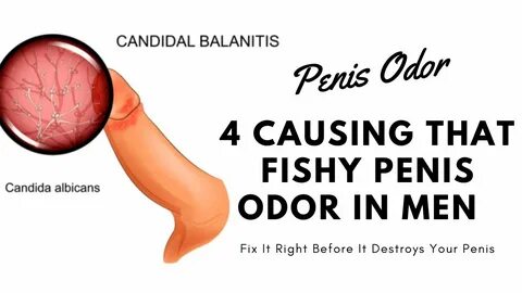 My penis has a fishy smell Smelly penis: 6 causes and how to