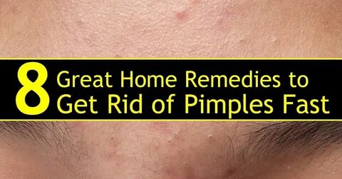8 Great Home Remedies to Get Rid of Pimples Fast