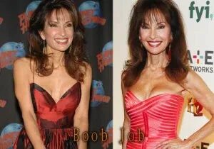 Susan Lucci Plastic Surgery, Before and After Facelift Pictu