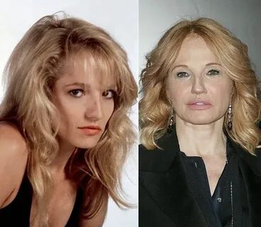 Ellen Barkin Plastic surgery, Celebrity plastic surgery, Bad