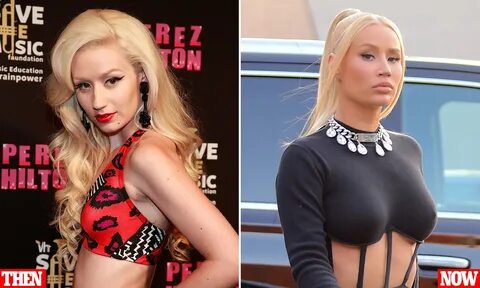 Iggy Azalea's incredible transformation after years of plastic surgery...