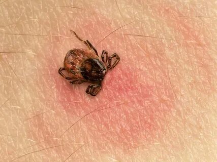 What You Need To Know About Bloodsucking Ticks