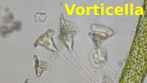 Amoeba Under Microscope 40X - Yogurt under a Microscope 40x 