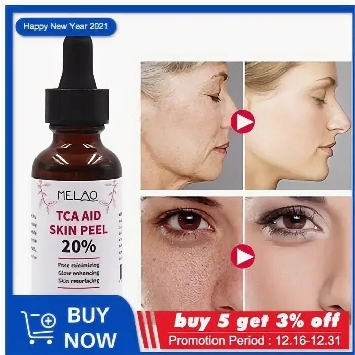 Купить 100 tca skin peel kit removes skin tags age spots whi