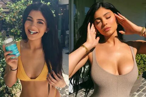 Kylie Jenner Plastic Surgery: Before and After Pictures - Wo