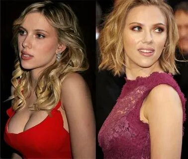 Scarlett Johansson Plastic surgery: Breast Reduction Before 