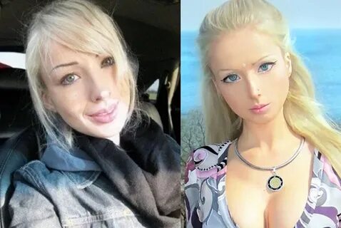 Valeria Lukyanova prima e dopo gli interventi chirurgici (FO