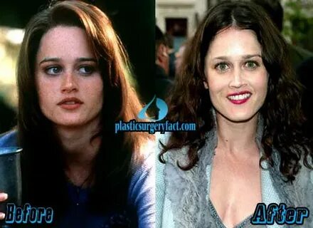 Robin Tunney Plastic Surgery Before and After Pictures - Pla