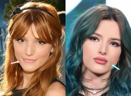 Did Bella Thorne Get Plastic Surgery? (Before & After 2022)