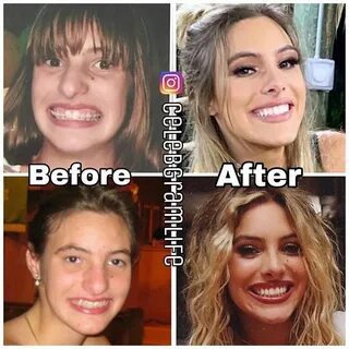 Lele Pons @lelepons before and after 🔥 👉 🏻 Follow @celebgraml