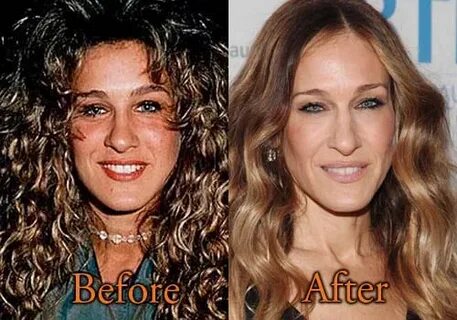 Sarah Jessica Parker Plastic Surgery, Before and After Nose 