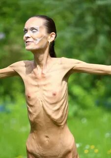 Anorexia nude. 