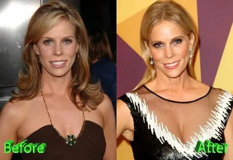 Cheryl Hines Before and After Plastic Surgery Plastic surger