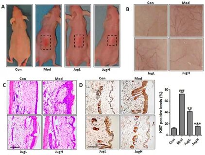 Juglanin ameliorates UVB‑induced skin carcinogenesis via ant