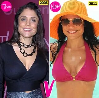 Bethenny-Frankel-Plastic-Surgery-Before-and-After-Photos-Boo