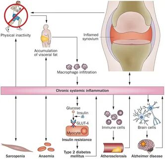 Exercise as an anti-inflammatory therapy for rheumatic disea