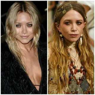 Mary Kate And Ashley Plastic Surgery