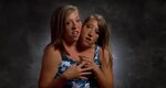 Abby And Brittany Hensel Are The World's Most Famous Conjoin