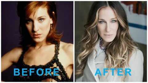 Sarah Jessica Parker Plastic Surgery, Before and After Photo