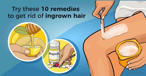 Home Remedies For Ingrown Hair 4A6