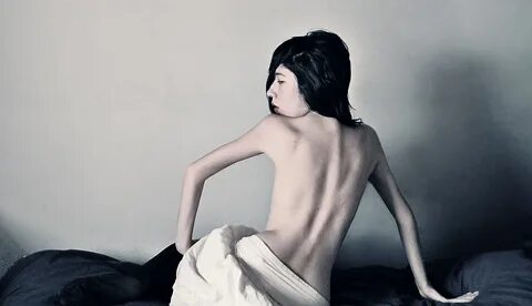 Contrasts of eating disorders Flickr