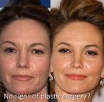 Diane lane plastic surgery - Plastic Surgery