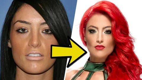 Wwe Plastic Surgery - Plastic Industry In The World