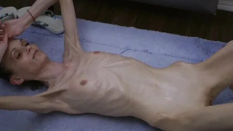 Anorexic Nude - Sex photos and porn