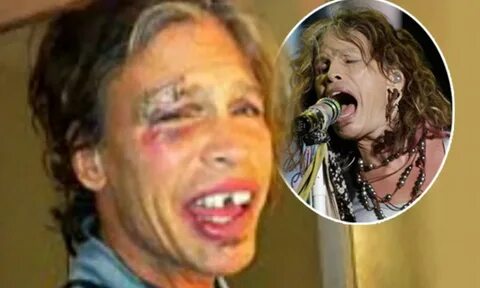 Steven Tyler injuries after hotel room fall: Singer insists 