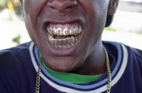 Hip Hop Gangsta Teeth Grillz (13 pics)