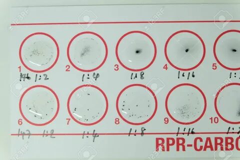 Rpr w reflex titer