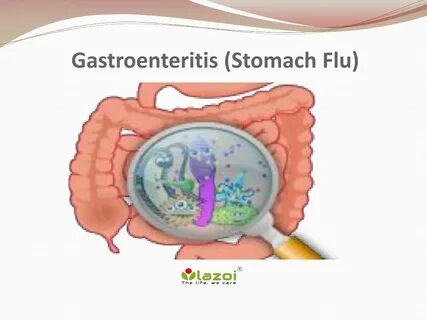 PPT - Gastroenteritis (Stomach Flu): Symptoms, causes, diagn