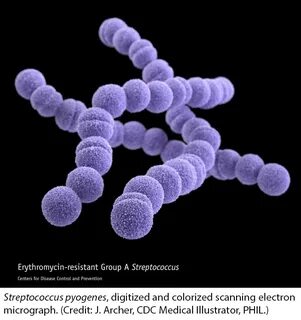 Streptococcus pyogenes (Group A Strep: GAS) - Microtosis