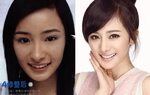 Plastic Surgery: Yang Mi’s Nose And Jaw Refinement - JayneSt
