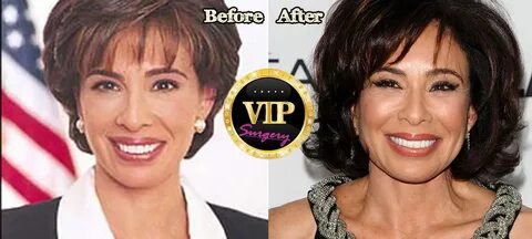 Jeanine Pirro Plastic Surgery Before and After Photos