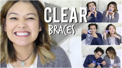 Affordable Clear Braces Smile Care Club - YouTube