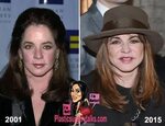 Stockard Channing Plastic Surgery Before & After Stockard ch